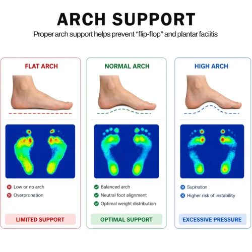 Shunox Arch Support Technology