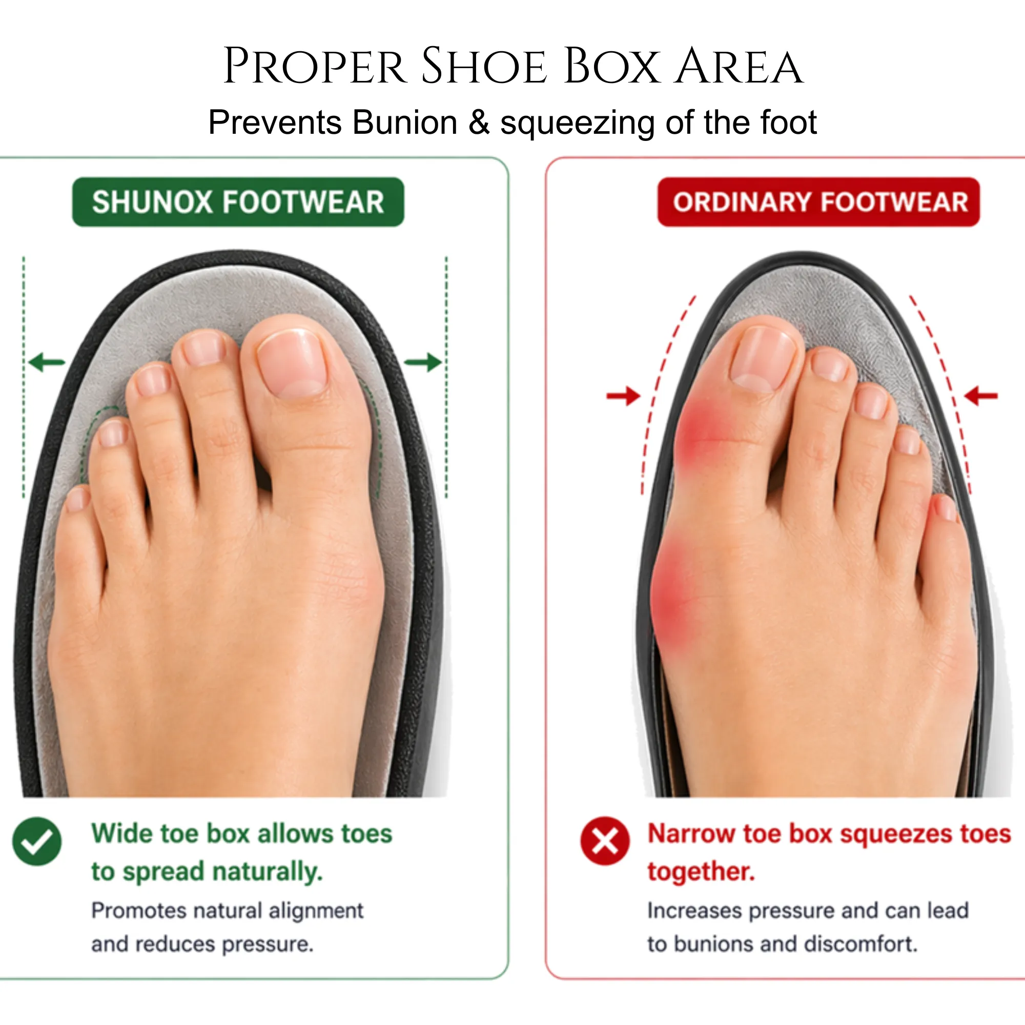 Shunox Proper Shoe Box Area