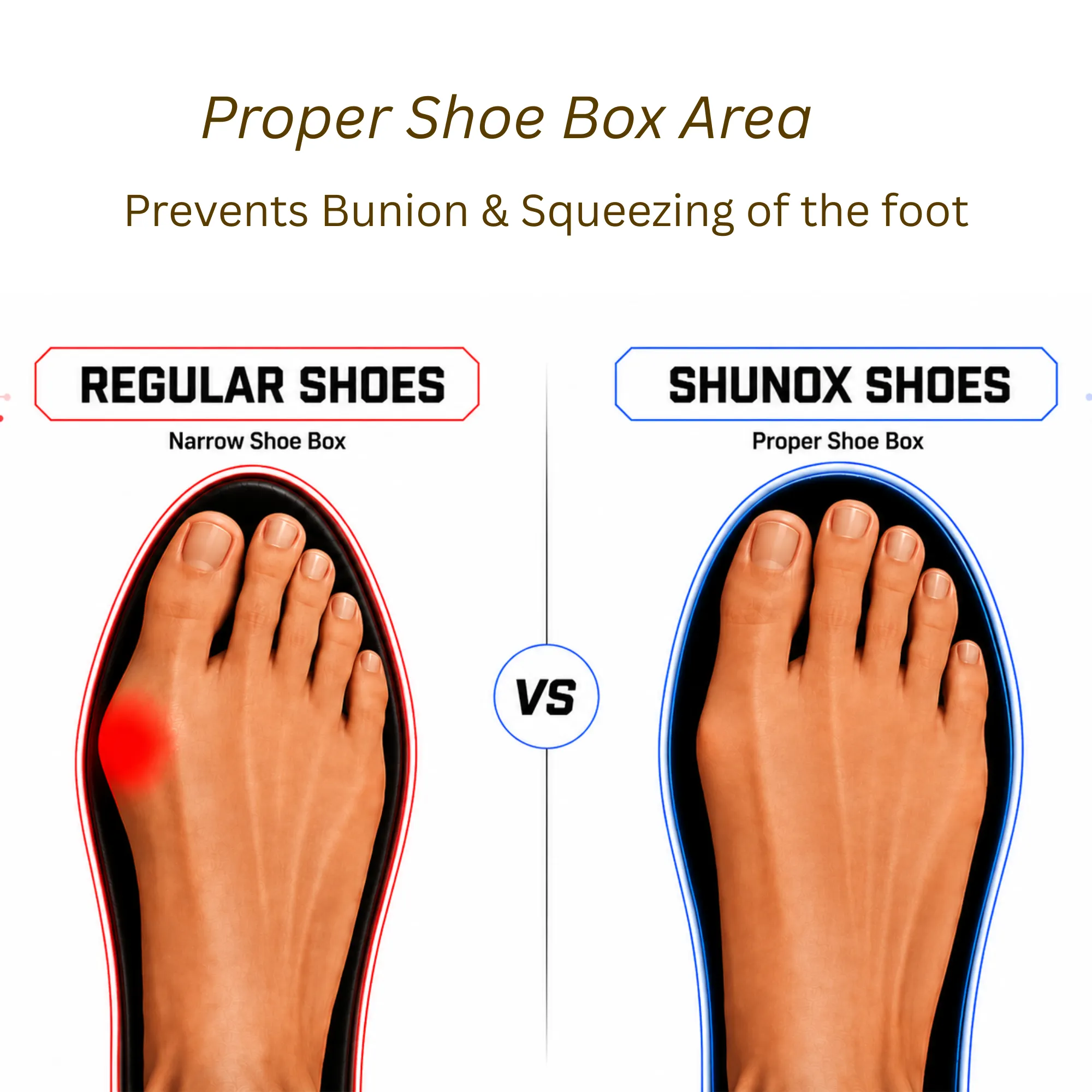 Proper Shoebox Area - SHUNOX